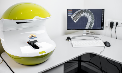 Scanner 3D